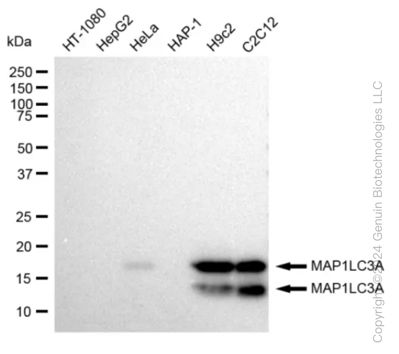 WB - KD-Validated Anti-MAP1LC3A Rabbit Monoclonal Antibody AGI1011